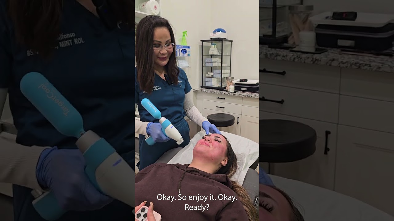 Morpheus8, Target Cool, and Klardie to Treat Acne Scars #sudburymedspa