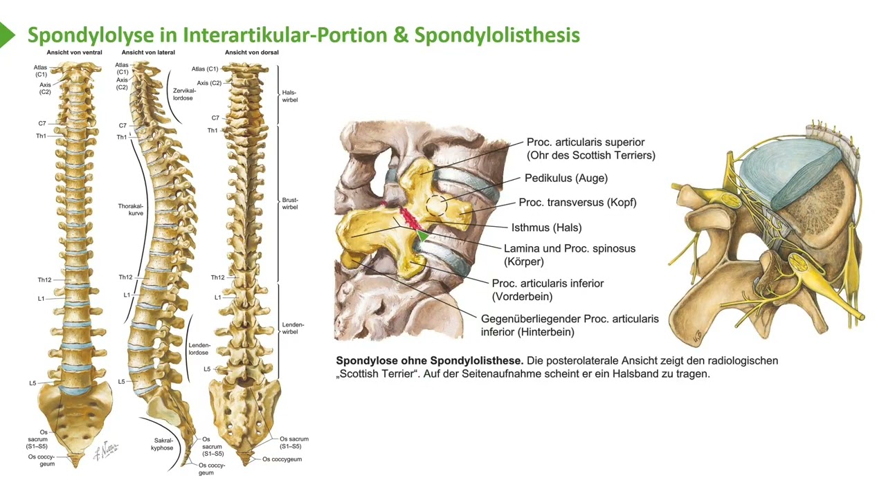 Anatomie I Bewegungssystem: Rücken (Knöcherne Strukturen) I Prof. Dr. med. Wirth