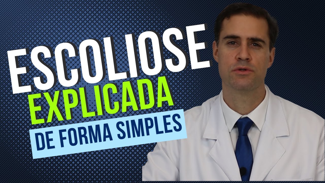 Escoliose de Crianças e Adolescentes explicada de forma Simples