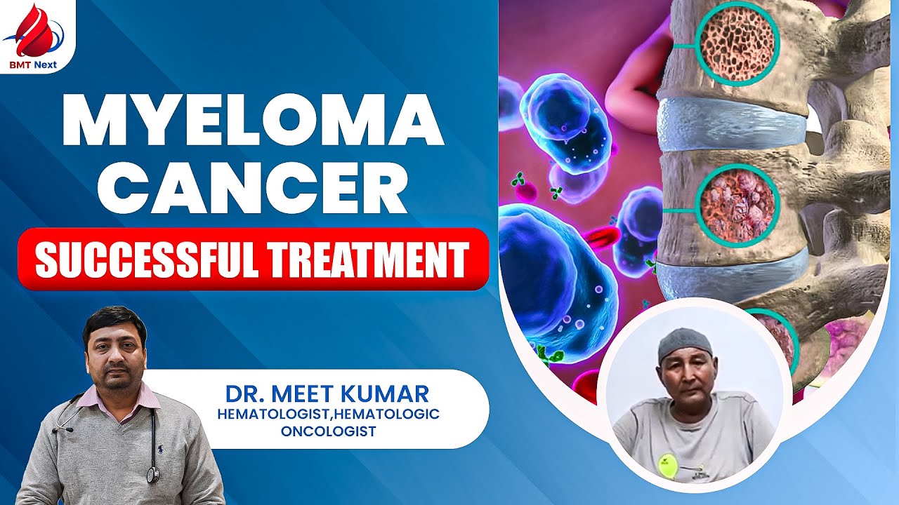 Cancer Patient Successful Story | Myeloma Cancer Treatment | Cancer Survivor Story | Dr Meet Kumar