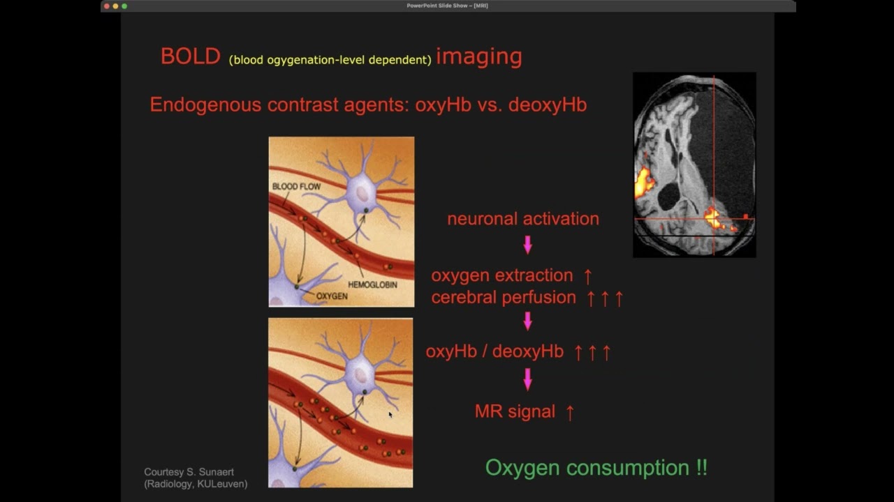 Medical Imaging Modalities -  MRI 3/3