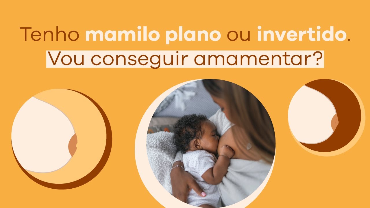 Tenho mamilo plano ou invertido.Vou conseguir amamentar?