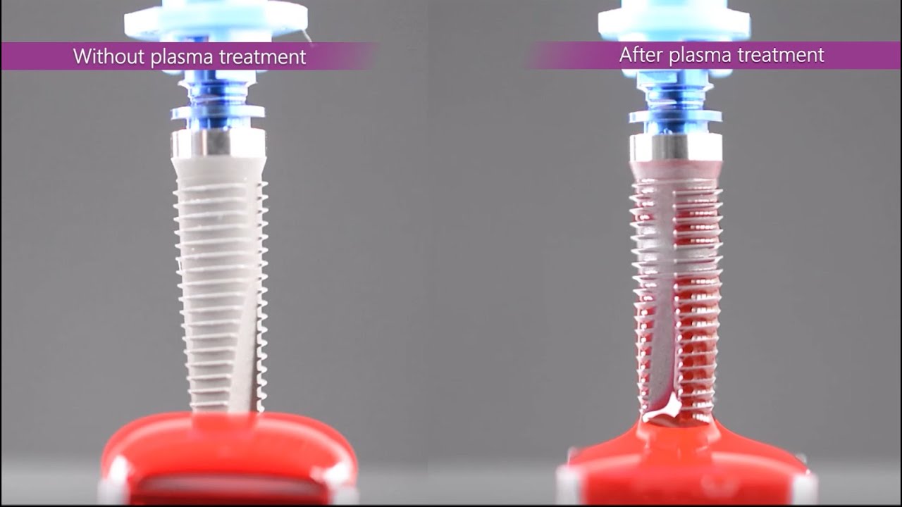 Plasma activation of implants with the implaPrep concept