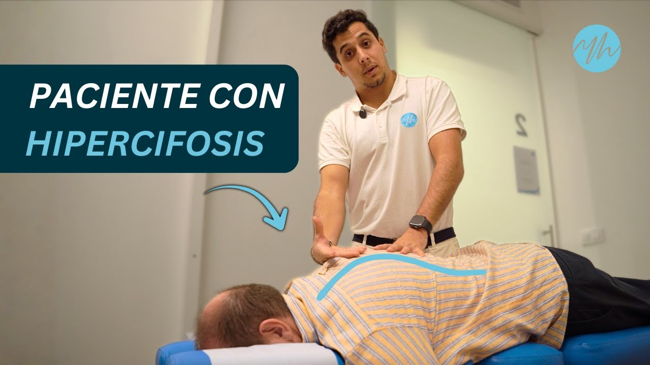 Elimina La Joroba Para Siempre | Paciente con Hipercifosis