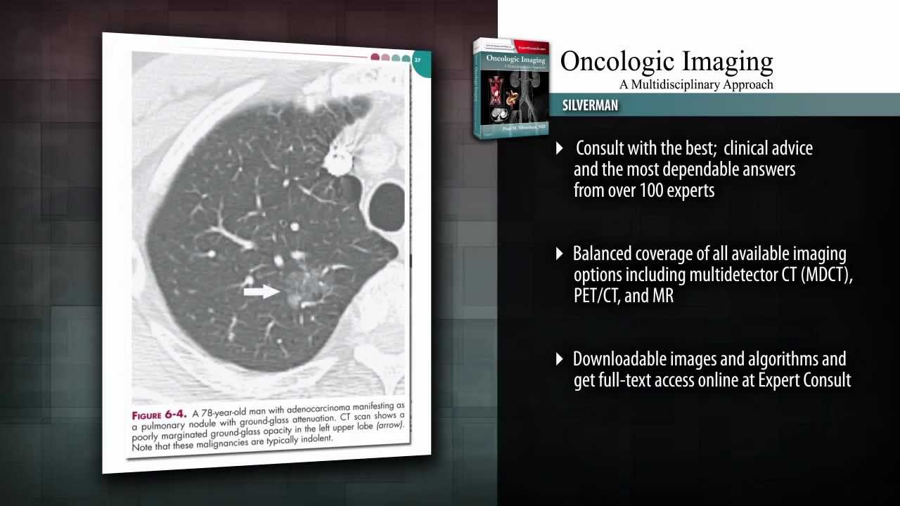 Oncologic Imaging: A Multidisciplinary Approach