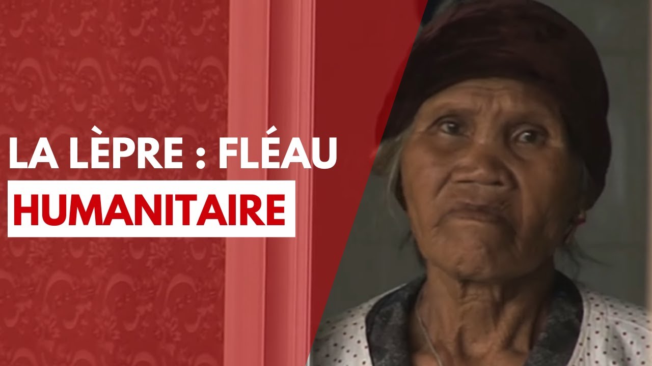 Ordre de Malte France - Lutte contre la lèpre