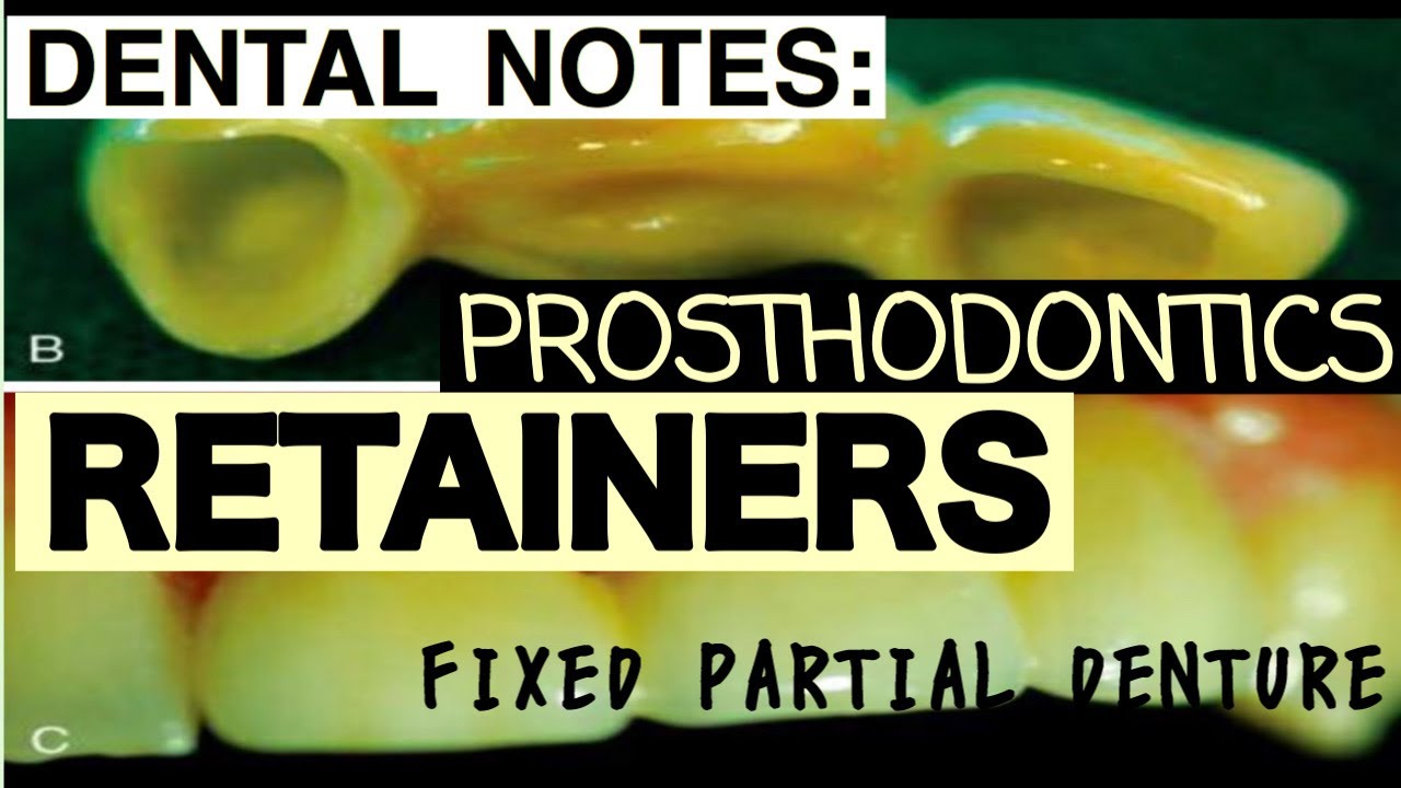 РЕЙТЕНЗИИ II КЛАССИФИКАЦИЯ И КРИТЕРИИ ВЫБОРА II НЕСЪЕМНЫЕ ЧАСТИЧНЫЕ ПРОТЕЗЫ II ПРОТЕЗИРОВАНИЕ