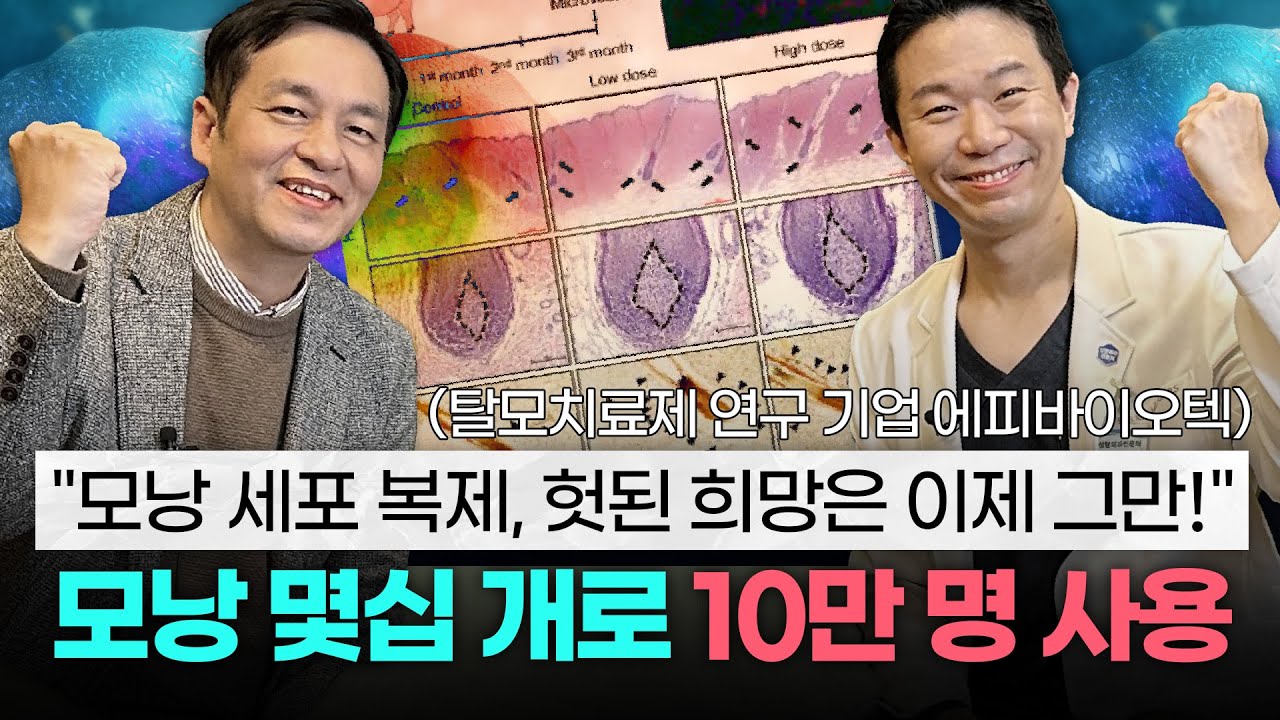 모유두세포 대량 복제로 탈모 극복?! 한 명의 모낭으로 10만 명 탈모치료 가능!