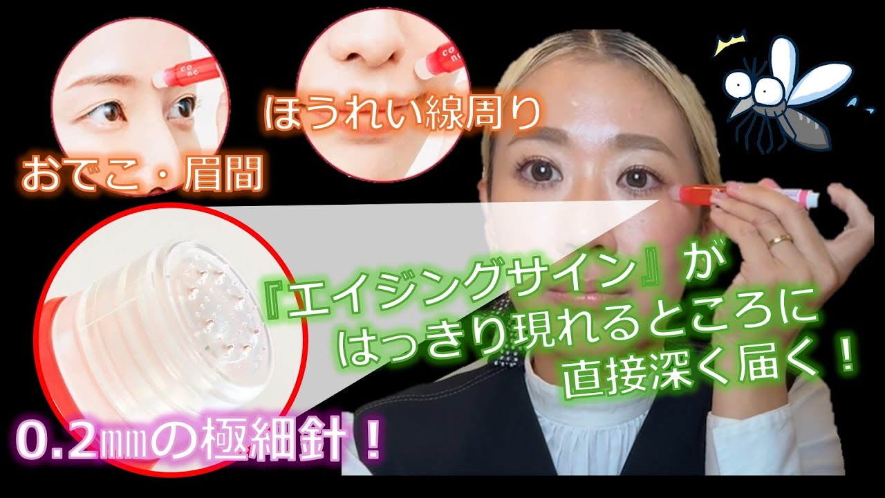 目元・口元・ほうれい線に瞬間注入！涙袋もつくれる☆彡『conc（コンク）リンクルインジェクション』のご紹介♪【SARA大名店：メグ】
