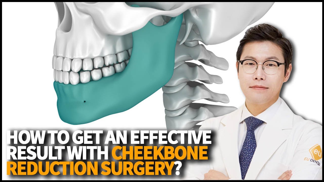 How to get an effective result with Cheekbone Reduction Surgery? What is Facial Contouring Surgery?