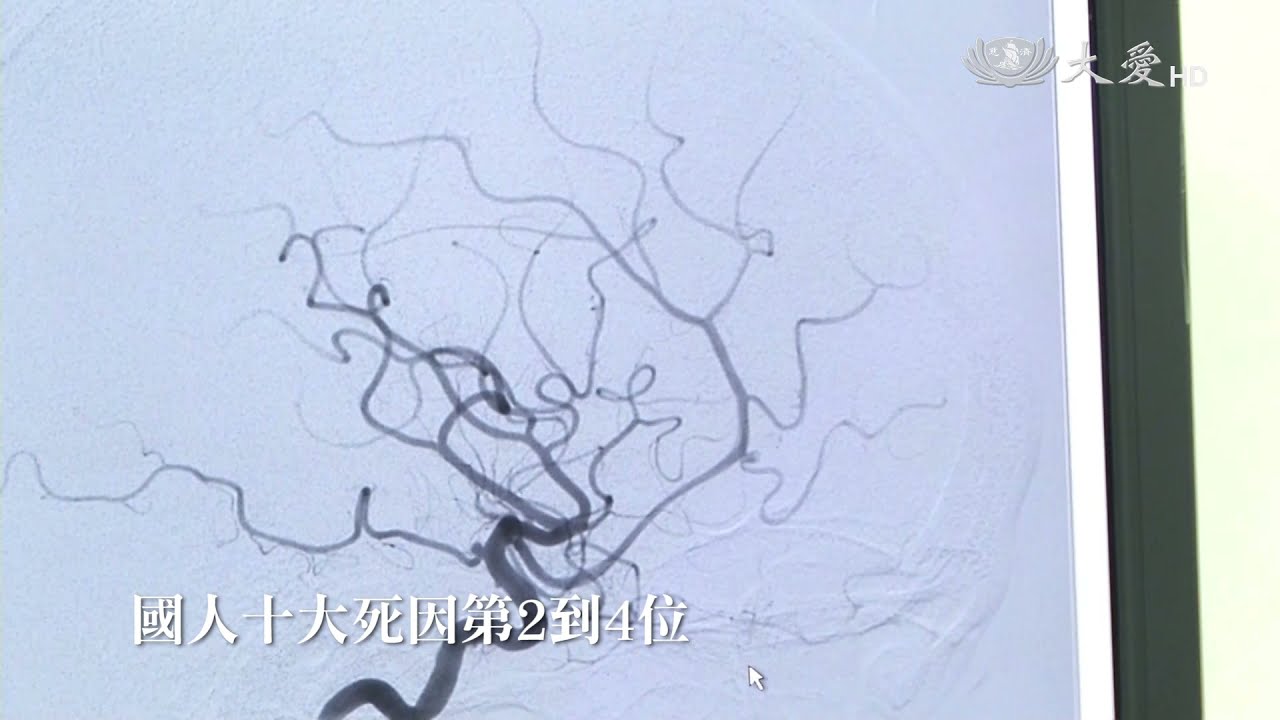 科學素 腦血管瘤 高危險群20211110