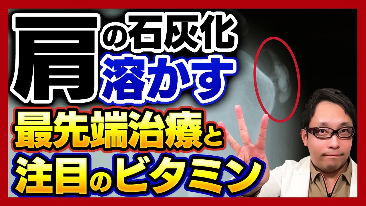 【最新版】肩の石灰沈着性腱板炎の治療&栄養素 TOP3