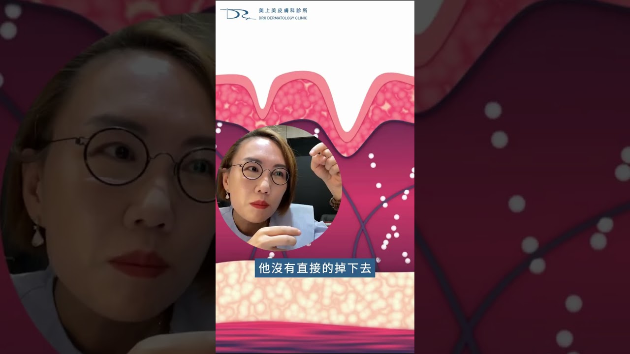為什麼打再多雷射痘疤平不了？