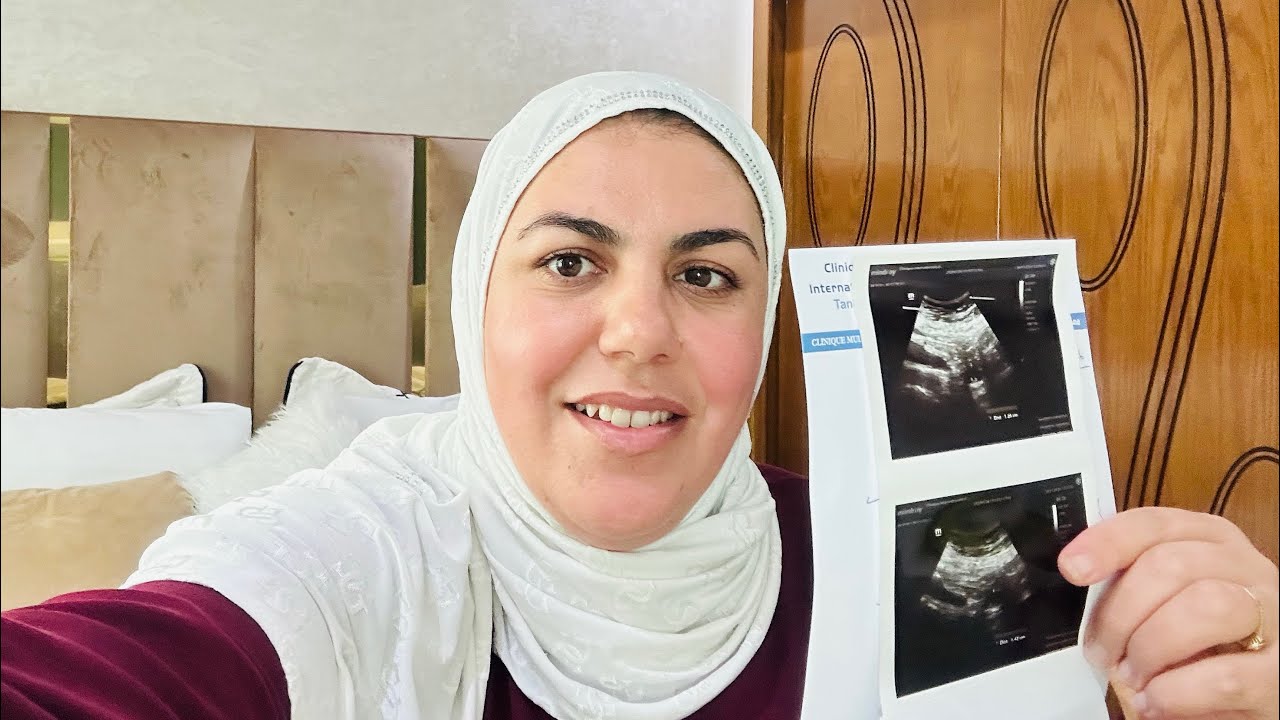 تسنينا كتير ولكن فالأخير ربي كبير🫃🫃  والسبب لي خلاني نبدل الطبيب  