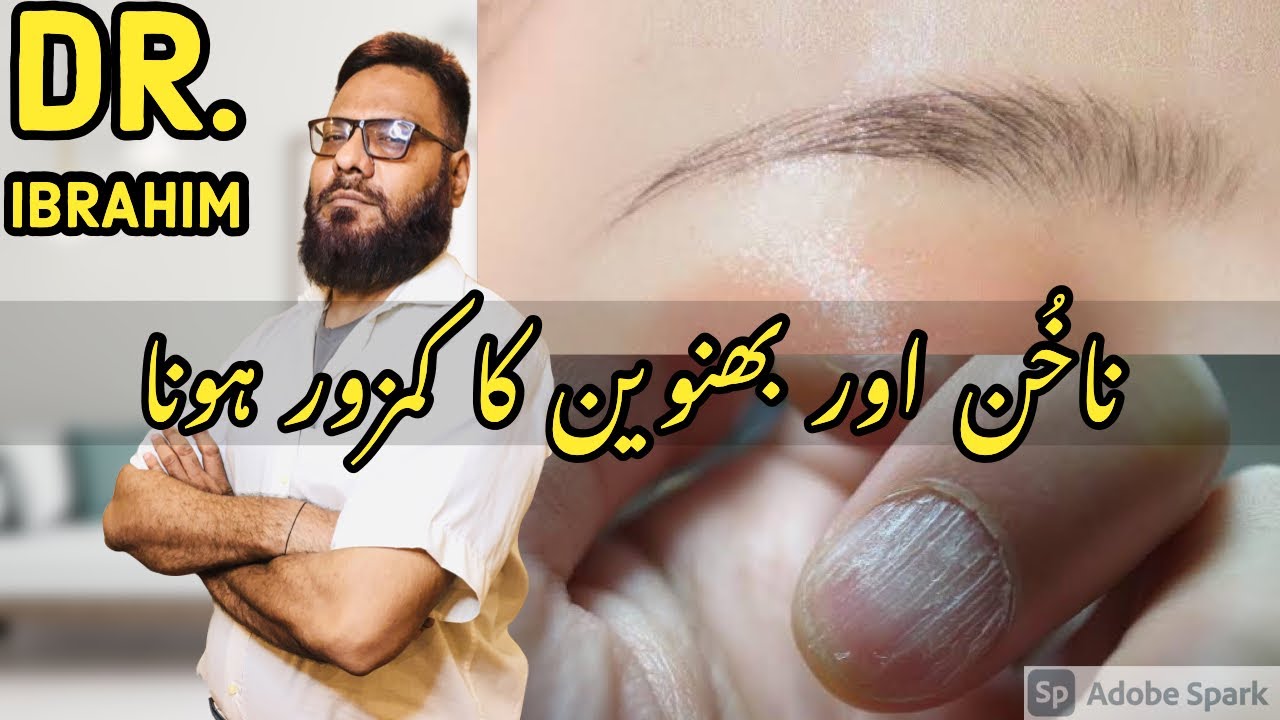 Kamzoor Nakun & Bhanwain Ka Asaan Elajj | How To Fix Weak Nails & Eyebrows | Dr. M. Ibrahim