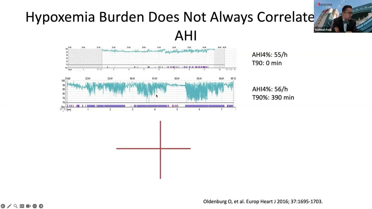 2025.09.16 - CWRU SMGR: Dr. Susheel Patil - Central Sleep Apnea Updates