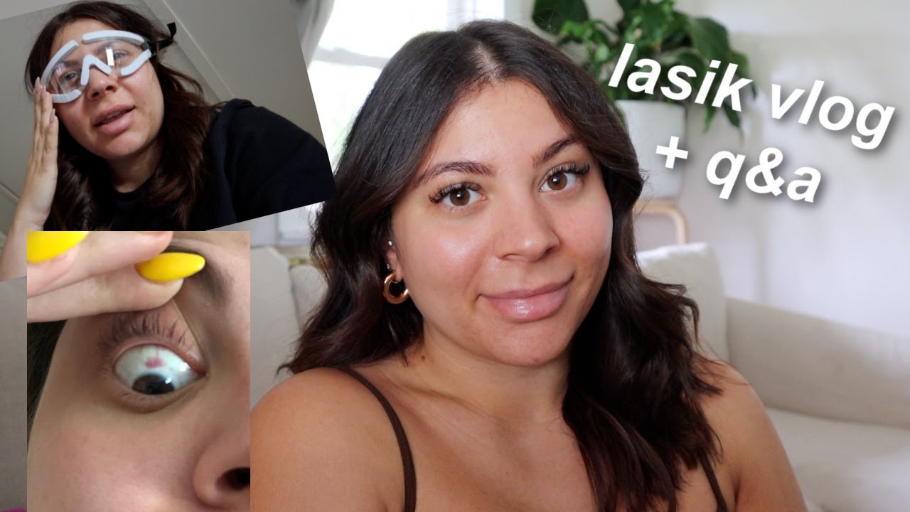 MY LASIK EYE SURGERY EXPERIENCE | PAIN, COST, RECOVERY, ETC.