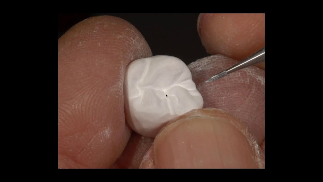 [Webinar] How to Get the Most Out of Zirconia Shading with Al Fillastre, CDT