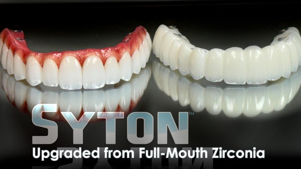 Upgrading a Patient to SYTON 7-Star From Full-Mouth Zirconia Implants