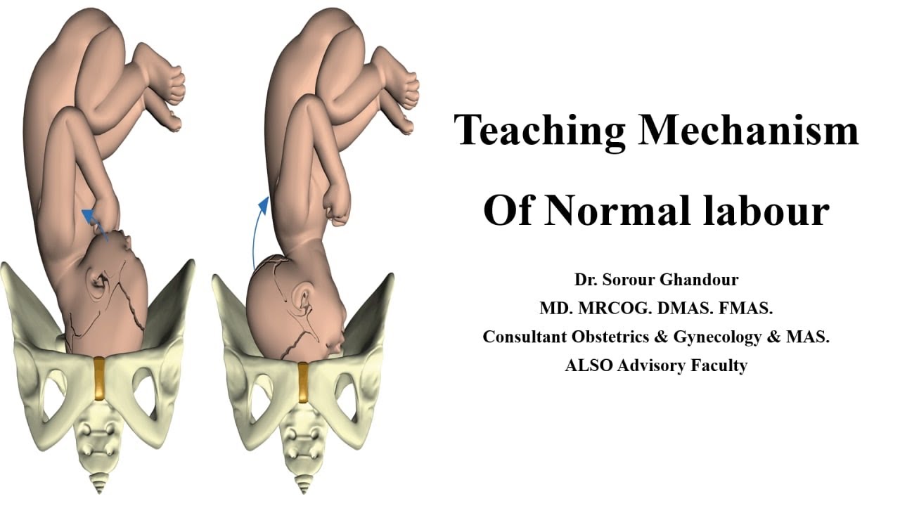 Mechanism of  Normal labour - Teaching Station for Part 3 MRCOG