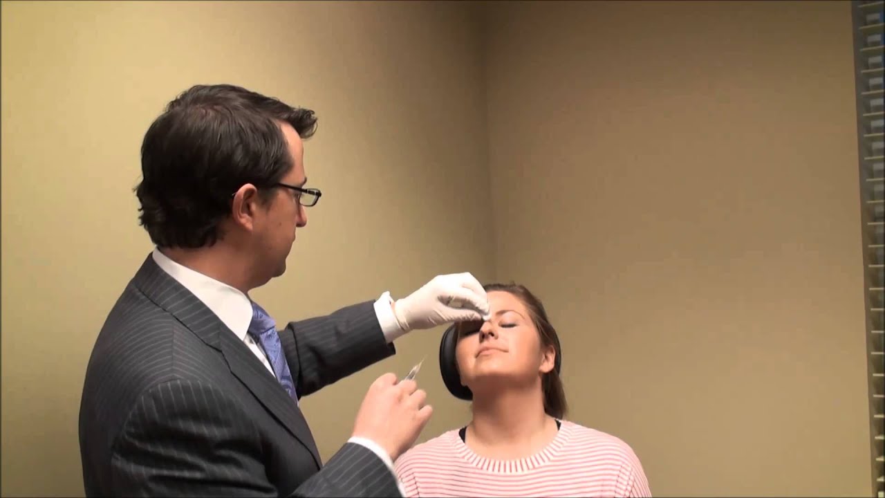 Non-Surgical Nose Job - Dr. Alex Donath