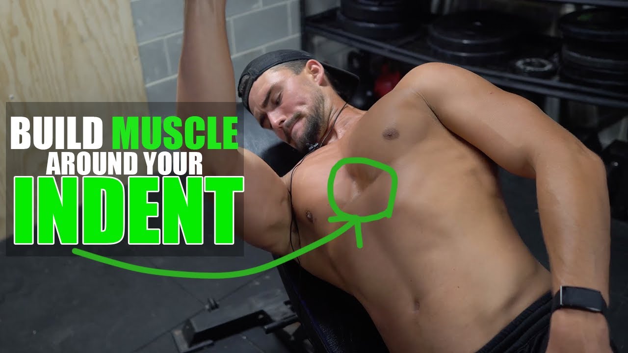 TRY THIS EXERCISE TO BUILD MUSCLE AROUND YOUR SUNKEN CHEST! (Pectus Excavatum Bodybuilding)