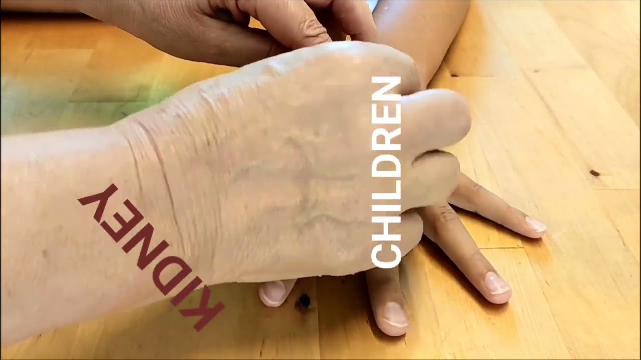 Sujok Kidney treatment of children    and adults #sujoktherapy