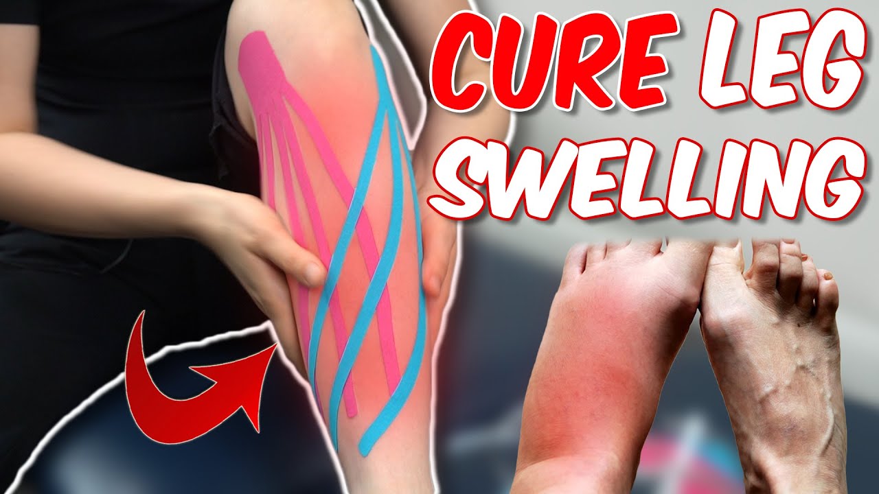 Easy Leg Taping for Swelling and Lymphedema with KT Tape Kinesiotape Ktape
