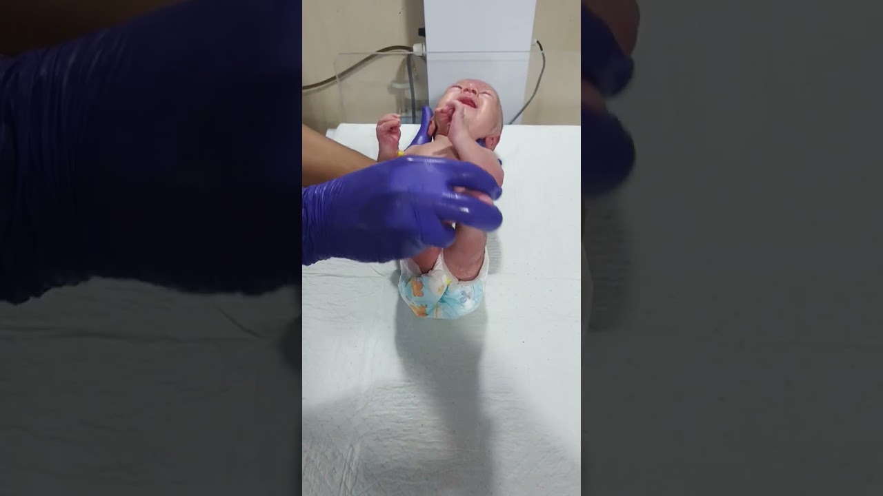 Physiotherapy little baby | Dignose with Arthrogryposis & Congenital Joint Contracture Care💆&zwj;♀️🩺💆&zwj;♀️