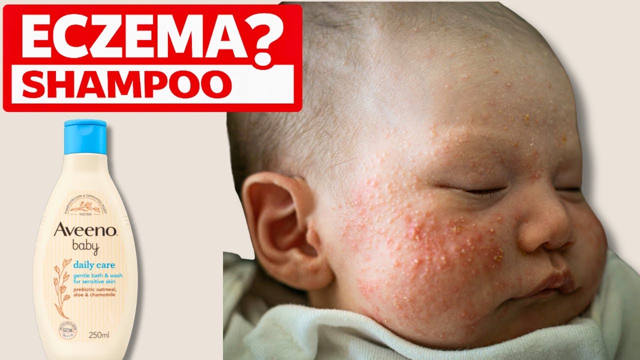 Best Shampoo for Baby Eczema? What We Actually Use