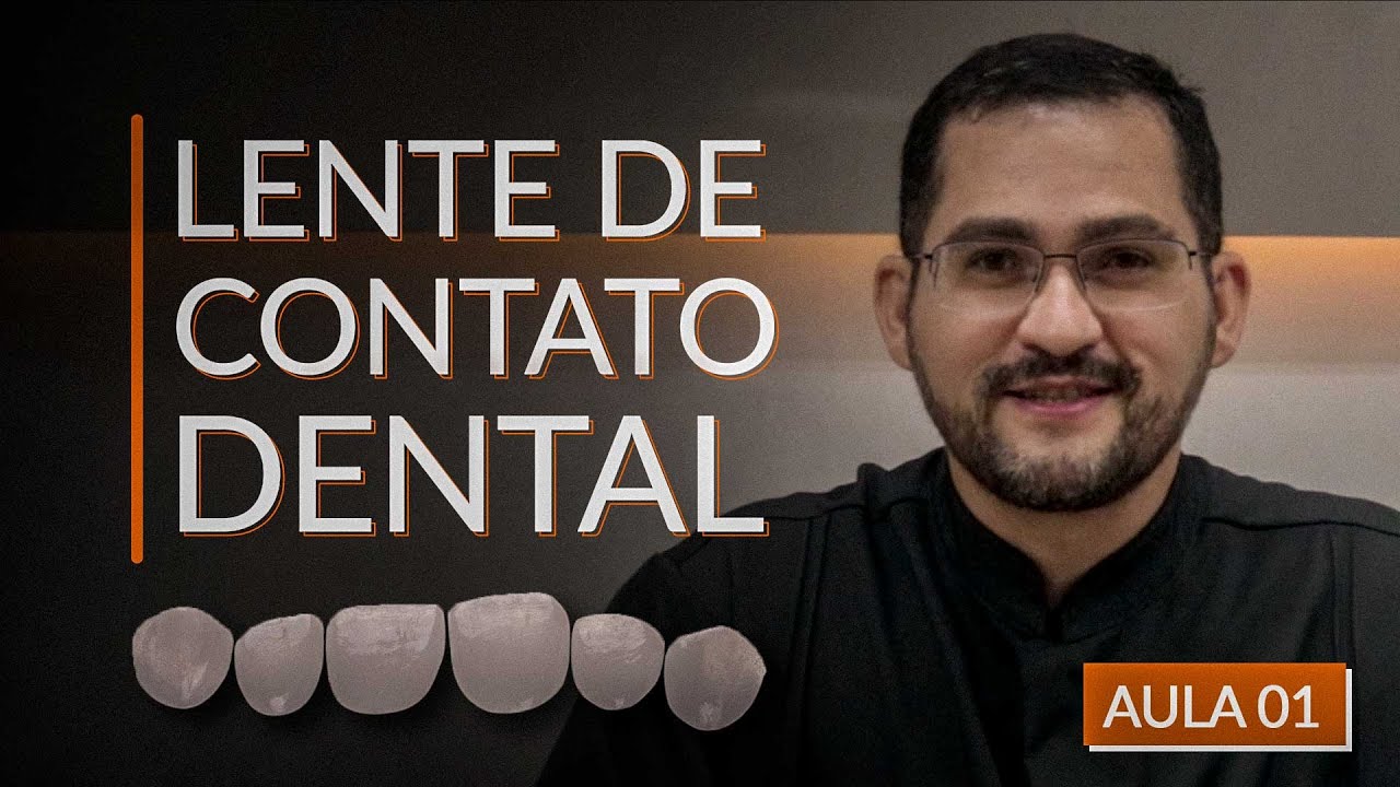 Como fazer lente de contato dental - passo a passo - Aula 01