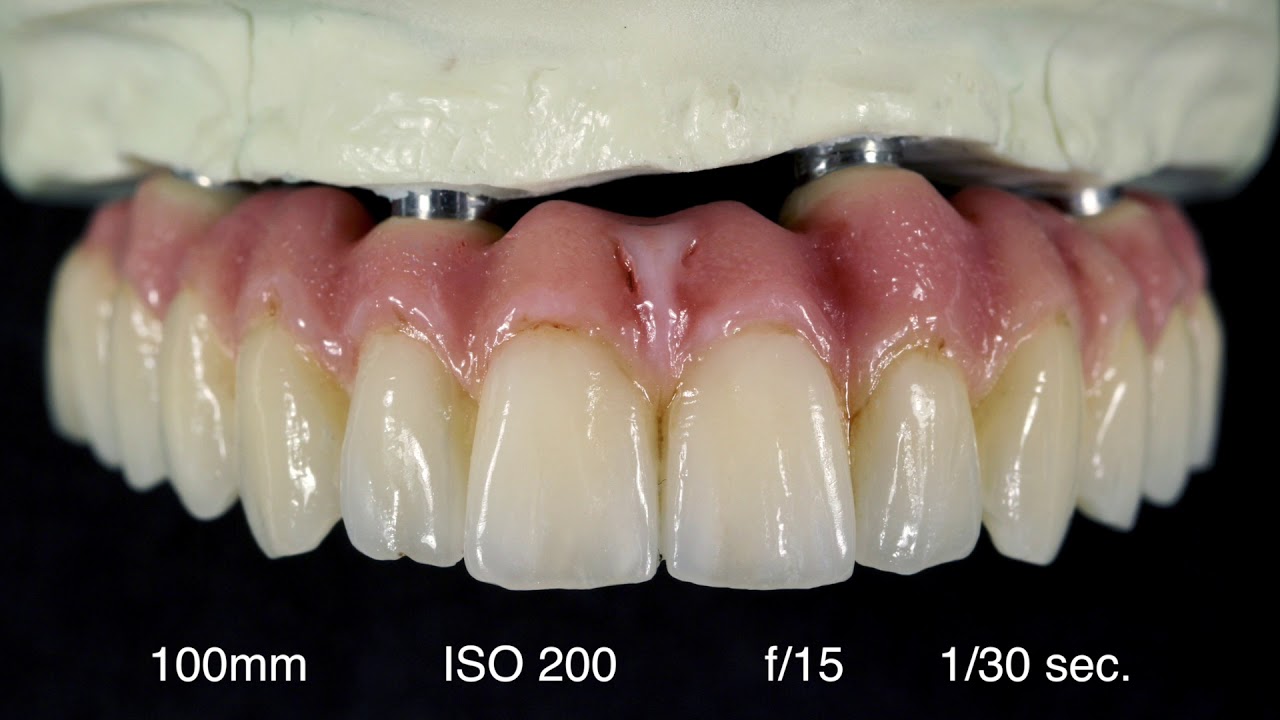 Digital Dental Photography (9 of 9) Fotografia Extraorale, Tip and Tricks