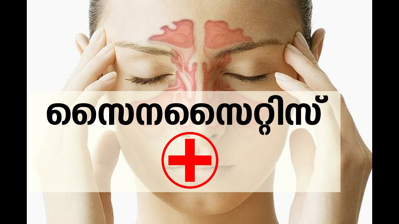സൈനസൈറ്റിസ് | Sinusitis | Dr. Live 27 March 2015