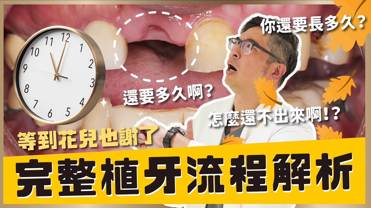 【植牙 #22】看這支影片就懂！少花冤枉錢做好每一步植牙準備！你以為植牙只是種顆牙？其實它是場高難度重建手術！完整植牙流程統統告訴你！【醫師說重點】｜【祐民牙醫－隱適美旗艦店】鑽石級楊大為醫師 #植牙