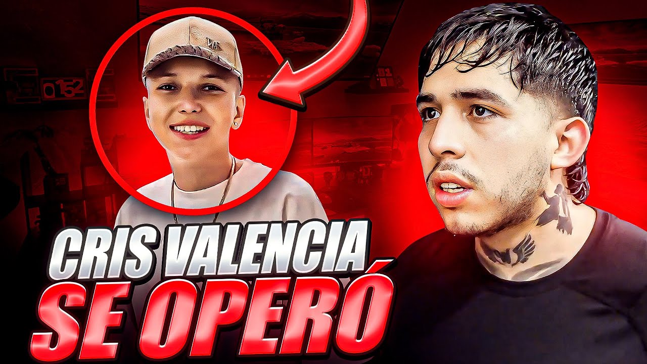 WESTCOL REACCIONA A CRIS VALENCIA OPERADO DE LA CARA *nuevo Justin Bieber* 😳