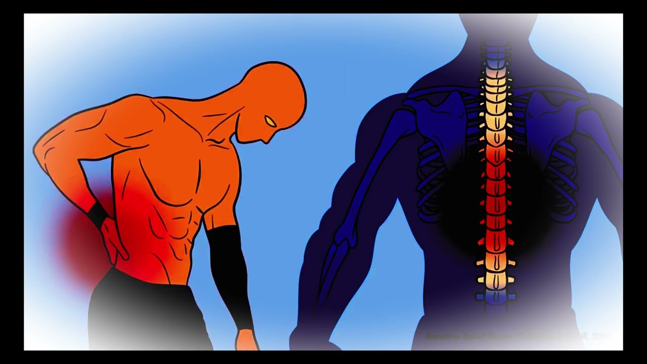 The problem with sit-ups