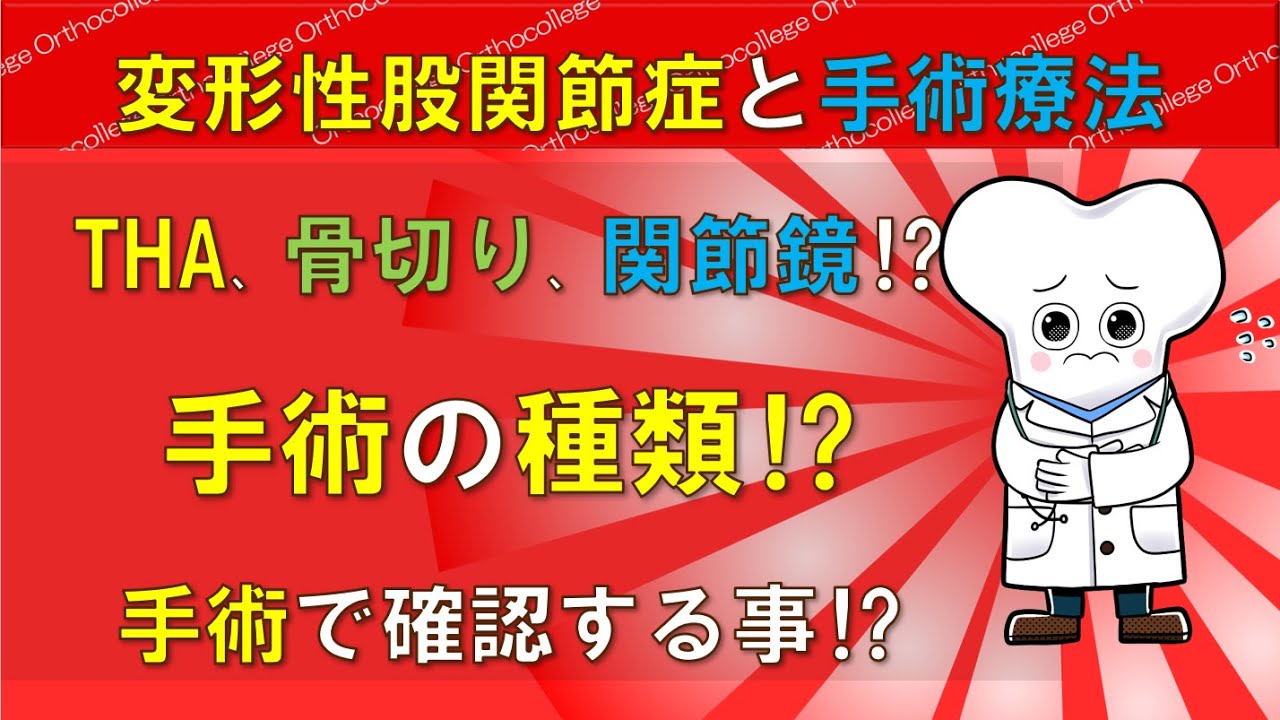 人工股関節置換術?骨切り?関節鏡? 変形性股関節症と手術療法 【医師が解説】