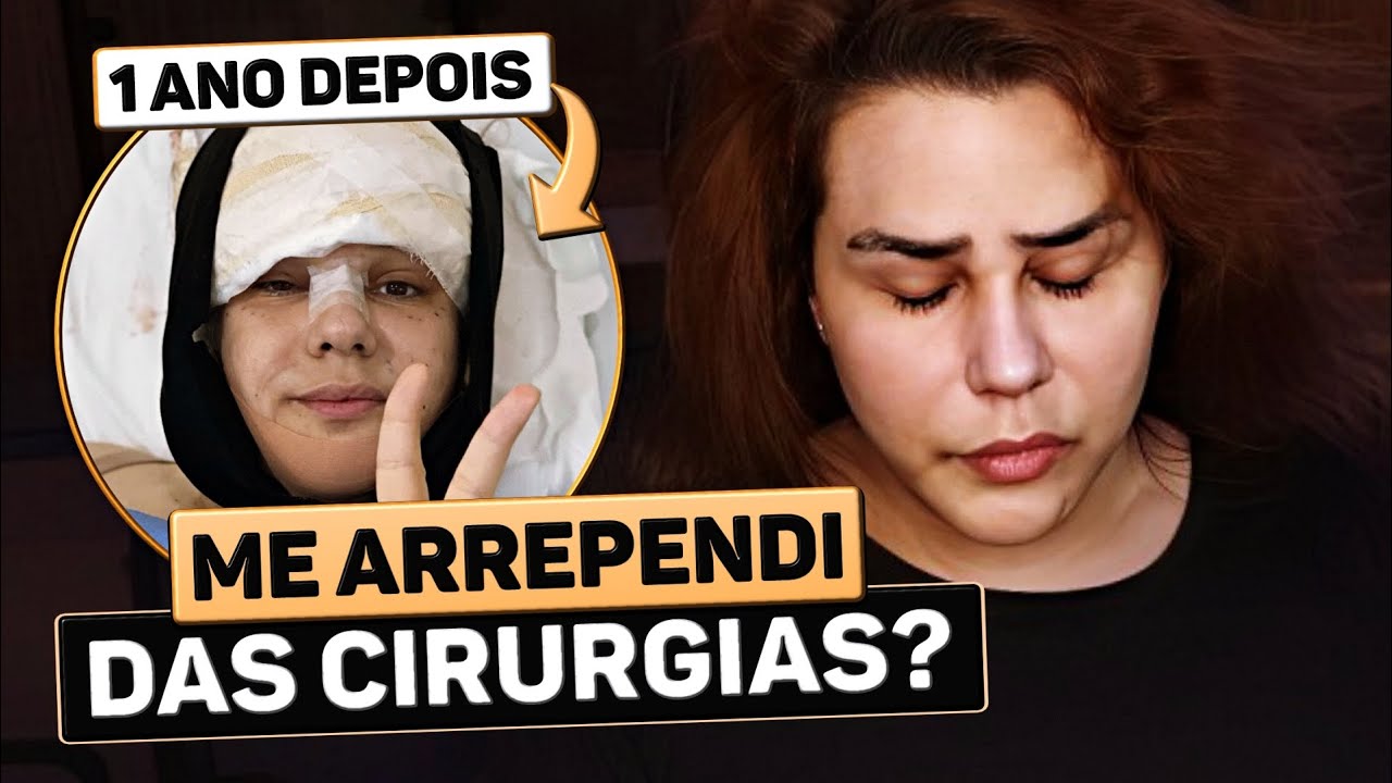 ME ARREPENDI DAS CIRURGIAS de transição DEPOIS de 1 ANO? 😞