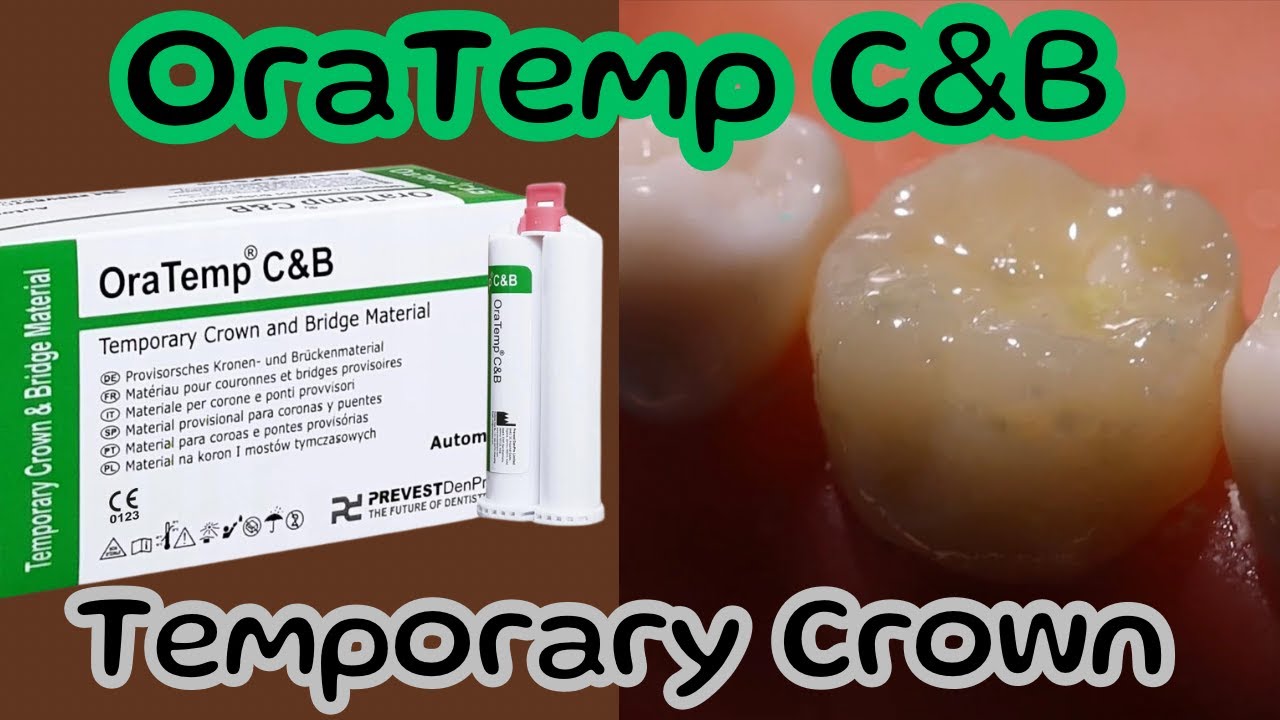OraTemp C&B ⚪️ Temporary Crown Preparation 🔵 #atozkidsdental #prevestdenpro
