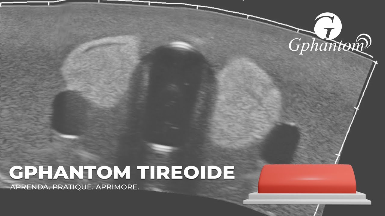 Gphantom Tireoide - Pratique bi&oacute;psia (PAAF) de tireoide guiada por ultrassom.