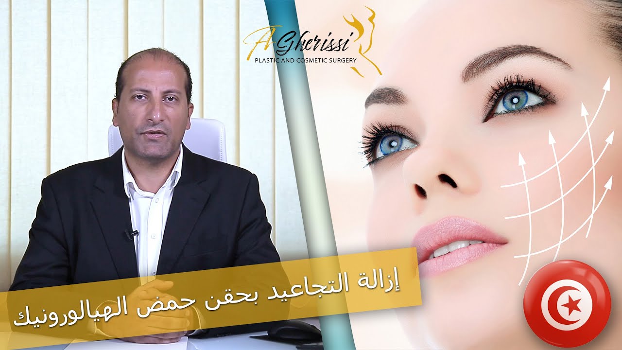 إزالة التجاعيد بحقن حمض الهيالورونيك - الفيلر