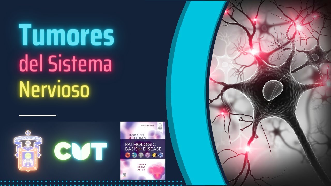 Emisión en directo - Tumores del sistema nervioso - Curso 2023A