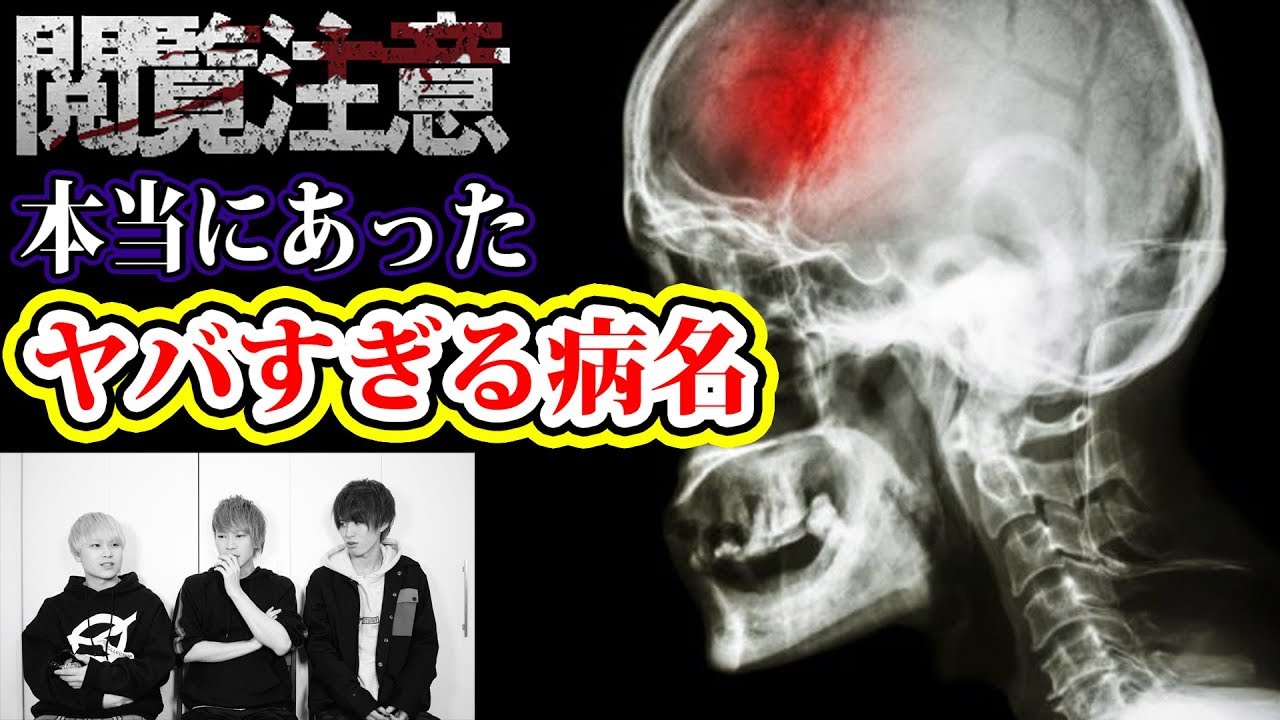 実在する「珍病名」がヤバすぎて他で話せる。【都市伝説】