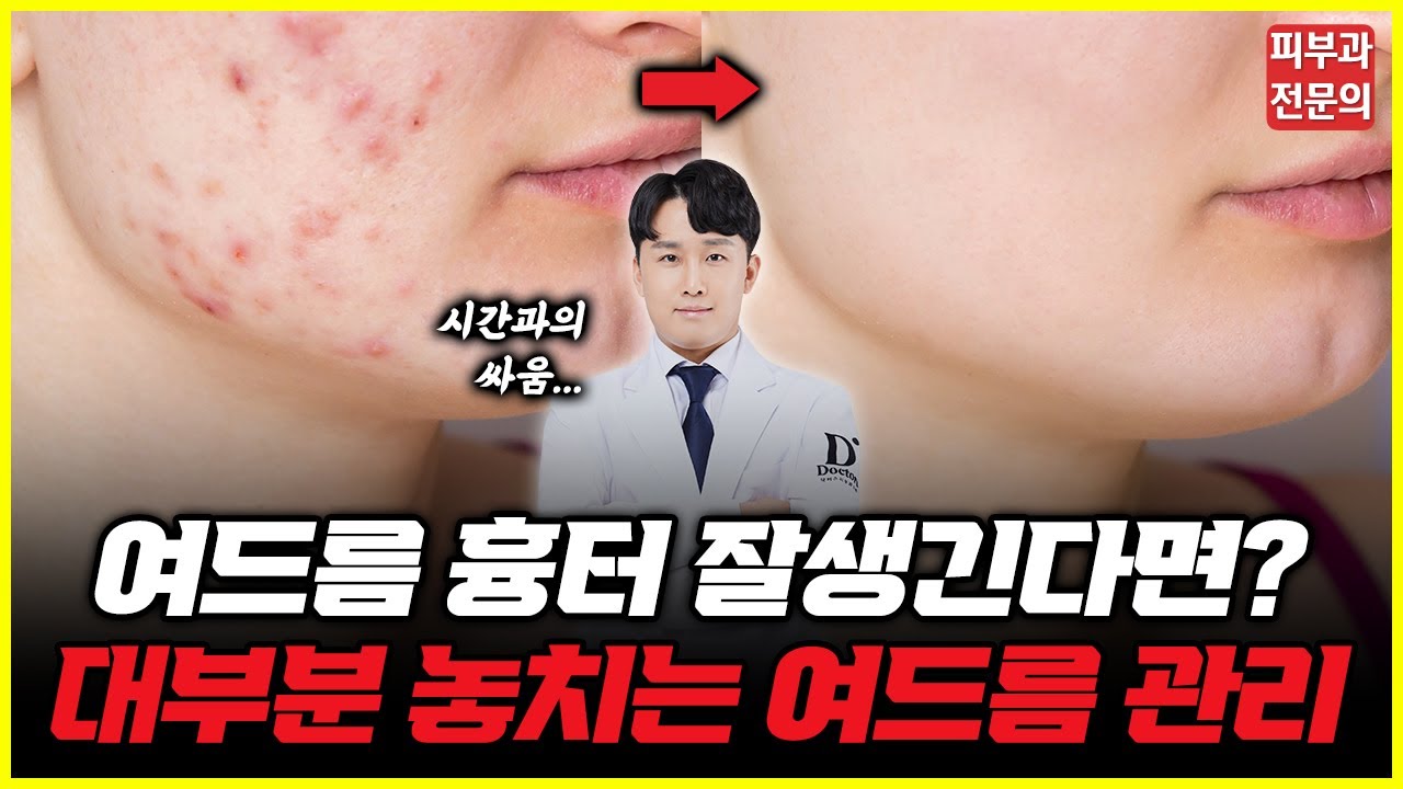 여드름 딱 이것만 알면 됩니다. 여드름 압출과 관리 방법 완벽 정리✅ (Feat. 목동 피부과전문의)
