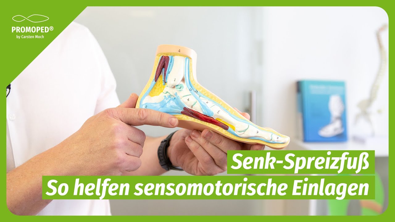 Senk-Spreizfuß - Die häufigste Fußfehlstellung Deutschlands