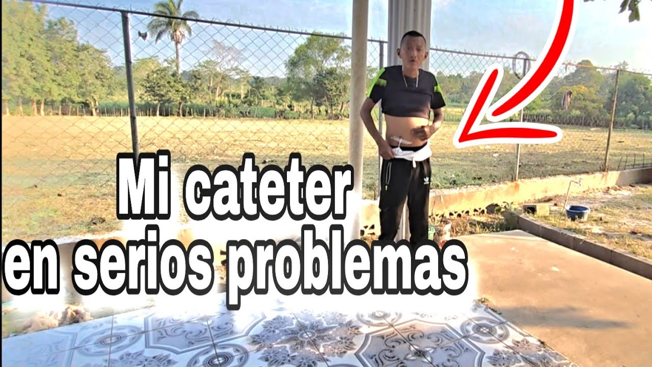 Tuve problemas con mi CATETER: un descuido y llego a Graves Problemas 😱