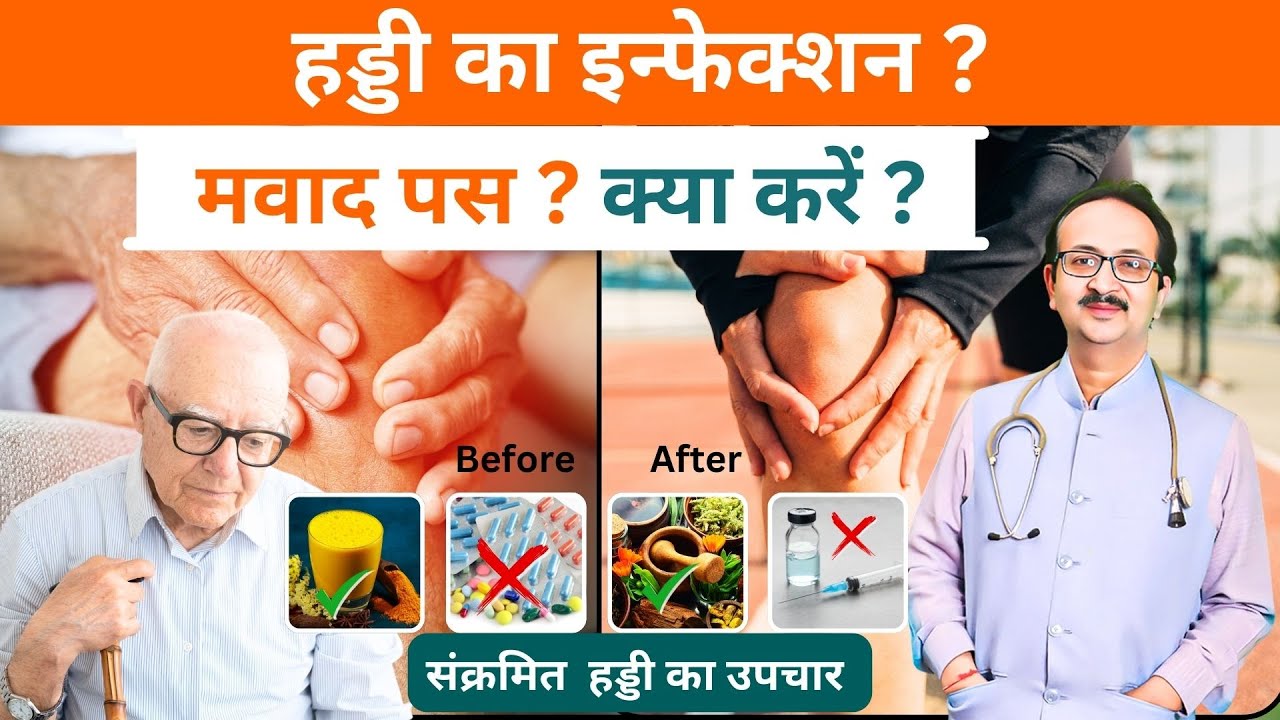 Bone Joint infection हड्डी का इन्फ़ेक्शन या मवाद पस हो जाए तो क्या करें | संक्रमित हड्डी का उपचार