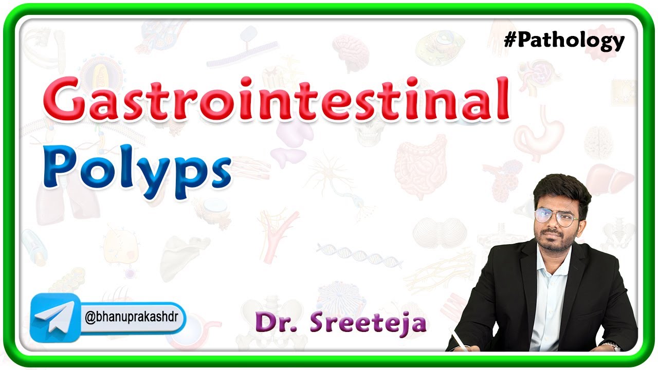12. Gastrointestinal Polyps | USMLE Step 1 Pathology