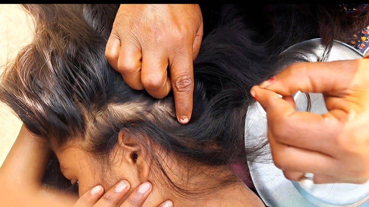 Deep Scalp ASMR Nitpicking 😴 | Relaxing Head Cleaning | Stress Relief Sleep Sound
