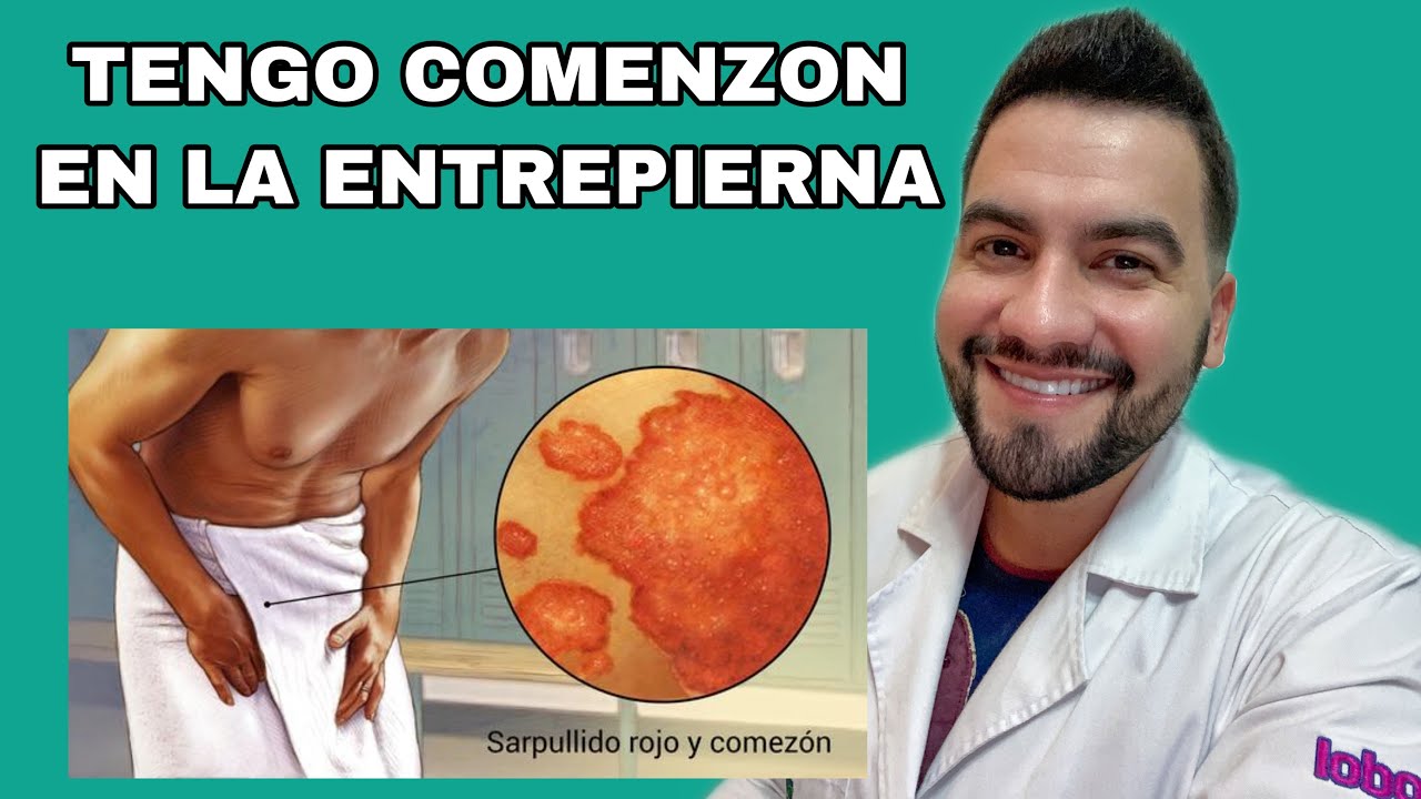 Tengo manchas rojas en la ingle que pican / Ti&ntilde;a Inguinal | DR. DAVID CAMPOS